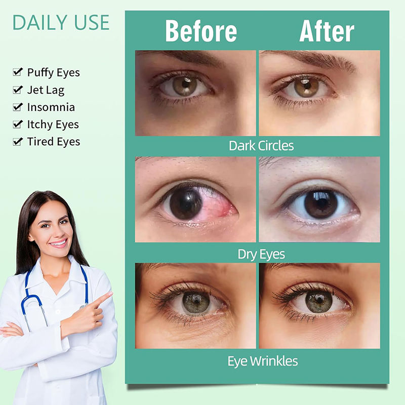 71muWeOG-dL._SL1500_ 22 Packs Steam Eye Masks, Disposable Self-Heating Eye Masks for Eye Care & Rest, Warm Compress Relieves Dry Eyes, Ideal for Sleep, Spa, Travel Essent